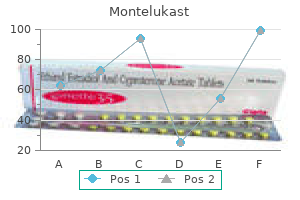 cheap montelukast 4 mg overnight delivery