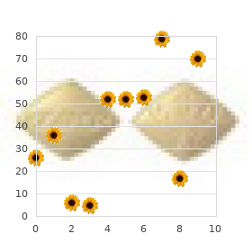 Ventricular extrasystoles perodactyly Robin sequence