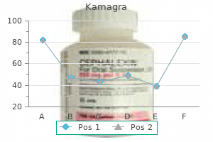 order 50 mg kamagra otc