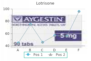 buy lotrisone on line amex