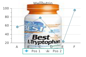 discount wellbutrin 300mg otc