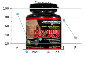 cheapest generic fosamax uk