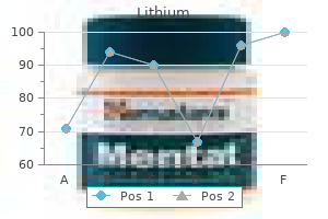 buy generic lithium 150mg on-line